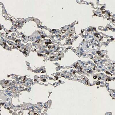 Immunohistochemistry-Paraffin: LPCAT1 Antibody [NBP1-88923] - Staining of human lung shows moderate to strong cytoplasmic positivity in pneumocytes.