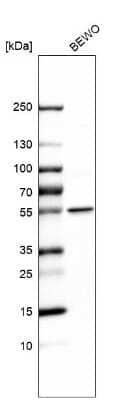 Western Blot LPCAT1 Antibody