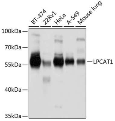 Western Blot: LPCAT1 Antibody [NBP3-04963] - Analysis of extracts of various cell lines, using LPCAT1 antibody at 1:1000 dilution. Secondary antibody: HRP Goat Anti-Rabbit IgG (H+L) at 1:10000 dilution. Lysates/proteins: 25ug per lane. Blocking buffer: 3% nonfat dry milk in TBST. Detection: ECL Basic Kit