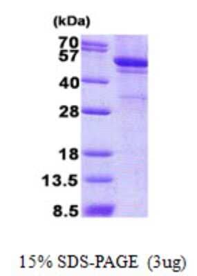 SDS-PAGE Recombinant Human LPCAT1 His Protein