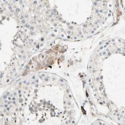 Immunohistochemistry-Paraffin: LPCAT2 Antibody [NBP1-88921] - Staining of human testis shows weak granular cytoplasmic positivity in Leydig cells.