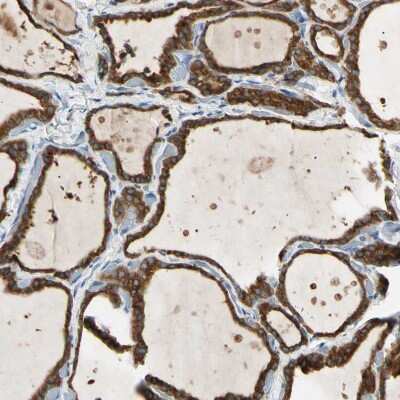 Immunohistochemistry-Paraffin: LPCAT2 Antibody [NBP1-88921] - Staining of human thyroid gland shows strong granular cytoplasmic positivity in glandular cells.