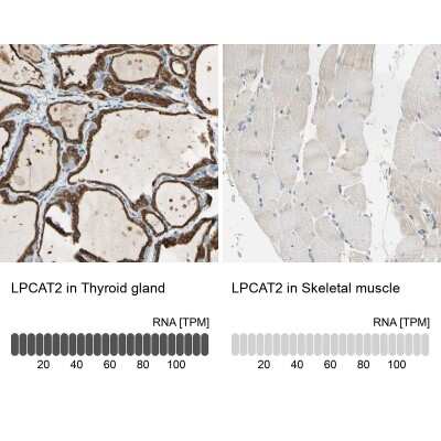 Immunohistochemistry-Paraffin: LPCAT2 Antibody [NBP1-88921] - Analysis in human thyroid gland and skeletal muscle tissues using NBP1-88921 antibody. Corresponding LPCAT2 RNA-seq data are presented for the same tissues.