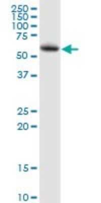 Western Blot: LPCAT2 Antibody [H00054947-B01P] - Analysis of LPCAT2 expression in A-431.