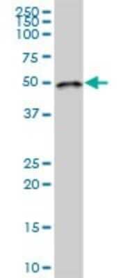 Western Blot LPCAT2 Antibody