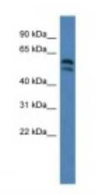 Western Blot LPCAT2 Antibody