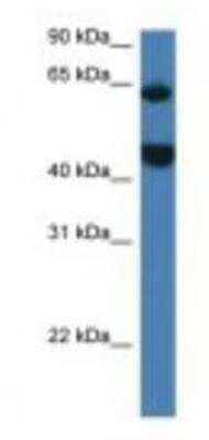 Western Blot: LPCAT2 Antibody [NBP1-79206] - Mouse Thymus Lysate 1.0ug/ml, Gel Concentration: 12%