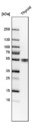 Western Blot: LPCAT2 Antibody [NBP1-88921] - Analysis in human thyroid gland tissue.