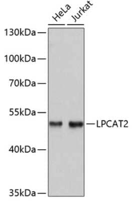 Western Blot: LPCAT2 Antibody [NBP3-04756] - Analysis of extracts of various cell lines, using LPCAT2 antibody at 1:3000 dilution. Secondary antibody: HRP Goat Anti-Rabbit IgG (H+L) at 1:10000 dilution. Lysates/proteins: 25ug per lane. Blocking buffer: 3% nonfat dry milk in TBST. Detection: ECL Basic Kit