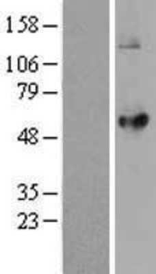 Western Blot LPCAT2 Overexpression Lysate