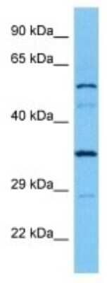 Western Blot: LPCAT3 Antibody [NBP3-10074] - Western blot analysis of LPCAT3 in Human Hela Whole Cell lysates. Antibody dilution at 1ug/ml