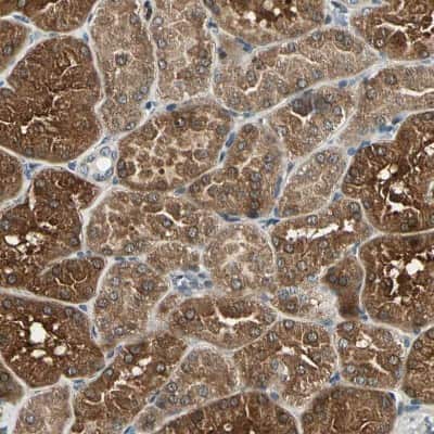 Immunohistochemistry-Paraffin: LPGAT1 Antibody [NBP1-83929] - Staining of human kidney shows moderate to strong cytoplasmic positivity in cells in tubules.