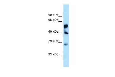 Western Blot LPGAT1 Antibody - BSA Free