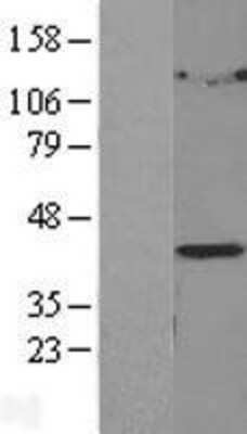 Western Blot LPGAT1 Overexpression Lysate