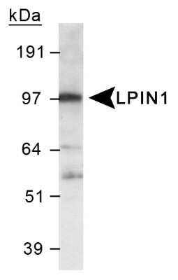 Western Blot: LPIN1 Antibody [NB110-57151] - Detection of LPIN1 in 3T3L1 lysate.