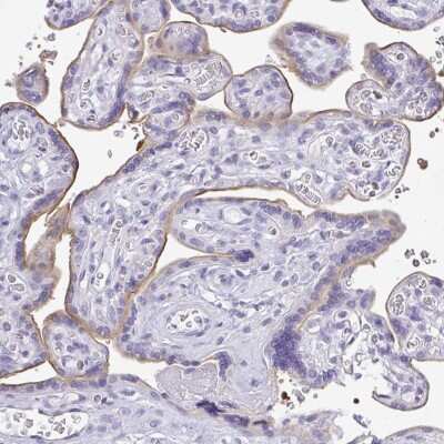 Immunohistochemistry-Paraffin LPPR3 Antibody - BSA Free