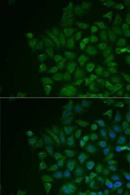 Immunocytochemistry/Immunofluorescence: LRAT Antibody [NBP3-04496] - Analysis of MCF7 cells using LRAT antibody . Blue: DAPI for nuclear staining.