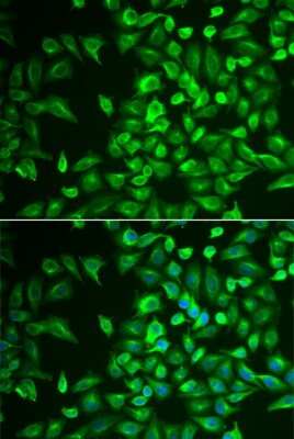 Immunocytochemistry/Immunofluorescence: LRAT Antibody [NBP3-04497] - Analysis of U2OS cells using LRAT antibody . Blue: DAPI for nuclear staining.