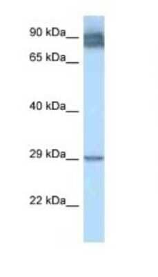 Western Blot: LRAT Antibody [NBP1-79775] - Titration: 1.0 ug/ml Positive Control: THP-1 Whole Cell.