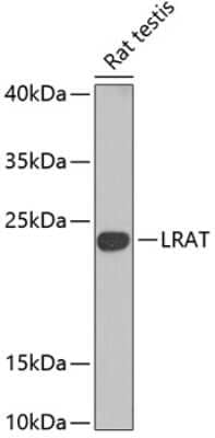 Western Blot: LRAT Antibody [NBP3-04497] - Analysis of extracts of rat testis, using LRAT antibody at 1:1000 dilution. Secondary antibody: HRP Goat Anti-Rabbit IgG (H+L) at 1:10000 dilution. Lysates/proteins: 25ug per lane. Blocking buffer: 3% nonfat dry milk in TBST. Detection: ECL Basic Kit .