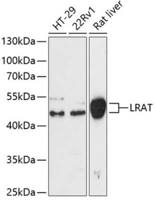 Western Blot: LRAT Antibody [NBP3-04954] - Analysis of extracts of various cell lines, using LRAT antibody at 1:3000 dilution. Secondary antibody: HRP Goat Anti-Rabbit IgG (H+L) at 1:10000 dilution. Lysates/proteins: 25ug per lane. Blocking buffer: 3% nonfat dry milk in TBST. Detection: ECL Enhanced Kit