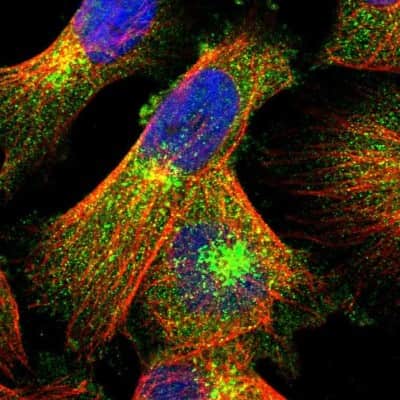 Immunocytochemistry/Immunofluorescence: LRBA Antibody [NBP1-90765] - Staining of human cell line U-251 MG shows localization to cytosol & the Golgi apparatus. Antibody staining is shown in green.