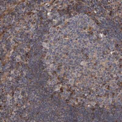 Immunohistochemistry-Paraffin: LRBA Antibody [NBP1-90764] - Immunohistochemical staining of human tonsil shows weak to moderate cytoplasmic positivity in lymphoid cells.