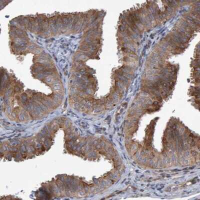Immunohistochemistry-Paraffin: LRBA Antibody [NBP1-90764] - Immunohistochemical staining of human fallopian tube shows moderate cytoplasmic positivity in glandular cells.