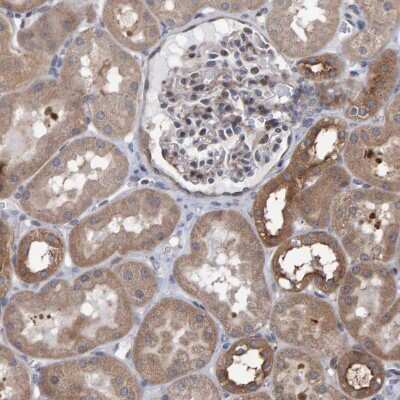 Immunohistochemistry-Paraffin: LRBA Antibody [NBP1-90764] - Immunohistochemical staining of human kidney shows moderate cytoplasmic positivity in cells in tubules, as well as weaker positivity in glomeruli.
