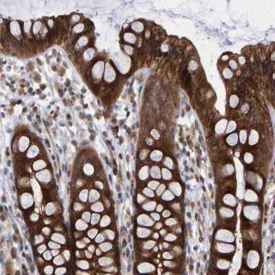 Immunohistochemistry-Paraffin: LRBA Antibody [NBP1-90764] - Immunohistochemical staining of human rectum shows strong cytoplasmic positivity in glandular cells.