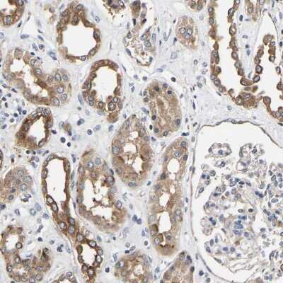 Immunohistochemistry-Paraffin: LRBA Antibody [NBP1-90765] - Staining of human kidney shows cytoplasmic positivity in cells in tubules and glomeruli.