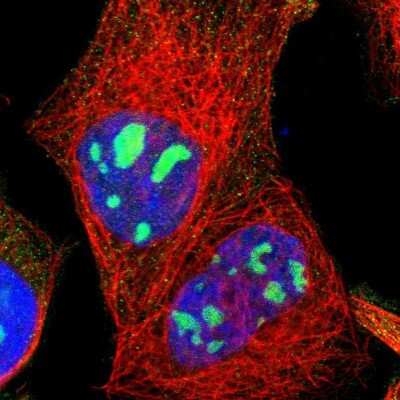 Immunocytochemistry/Immunofluorescence: LRCH2 Antibody [NBP1-93588] - Immunofluorescent staining of human cell line A-431 shows localization to nucleoli.