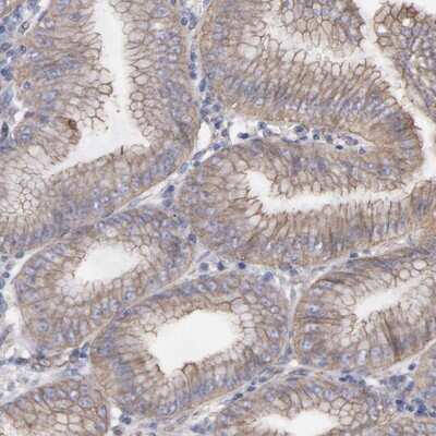Immunohistochemistry-Paraffin: LRCH2 Antibody [NBP1-93588] - Staining of human stomach shows cytoplasmic and membranous positivity in glandular cells.