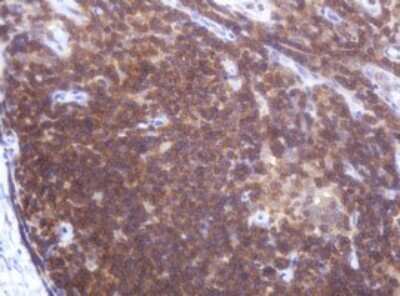 Immunohistochemistry: LRCH4 Antibody (1F8) [NBP2-45795] - Analysis of Human lymph node tissue. (Heat-induced epitope retrieval by 10mM citric buffer, pH6.0, 120C for 3min)