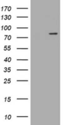 Western Blot: LRCH4 Antibody (1F8) [NBP2-45795] - Analysis of HEK293T cells were transfected with the pCMV6-ENTRY control (Left lane) or pCMV6-ENTRY LRCH4.