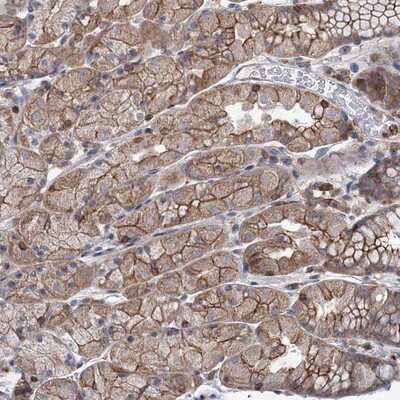 Immunohistochemistry-Paraffin: LRCH4 Antibody [NBP1-81288] - Staining of human stomach shows moderate cytoplasmic and membranous positivity in glandular cells.