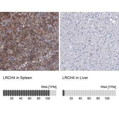 Immunohistochemistry-Paraffin: LRCH4 Antibody [NBP1-81288] - Staining in human spleen and liver tissues using anti-LRCH4 antibody. Corresponding LRCH4 RNA-seq data are presented for the same tissues.