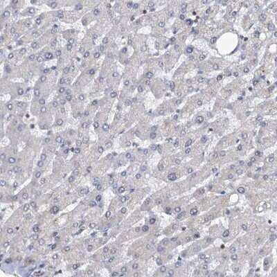 Immunohistochemistry-Paraffin: LRCH4 Antibody [NBP1-82821] - Staining of human liver shows low expression as expected.