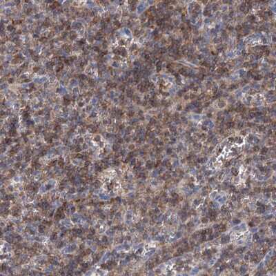 Immunohistochemistry-Paraffin: LRCH4 Antibody [NBP1-82821] - Staining of human spleen shows high expression.