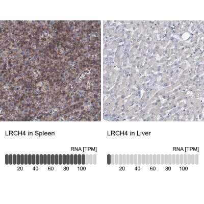 Immunohistochemistry-Paraffin: LRCH4 Antibody [NBP1-82821] - Staining in human spleen and liver tissues using anti-LRCH4 antibody. Corresponding LRCH4 RNA-seq data are presented for the same tissues.