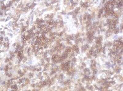 Immunohistochemistry: LRCH4 Antibody (OTI1F8) - Azide and BSA Free [NBP2-72520] - Analysis of Human lymphoma tissue. (Heat-induced epitope retrieval by 10mM citric buffer, pH6.0, 120C for 3min)