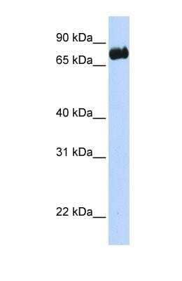 Western Blot: LRCH4 Antibody [NBP1-69264] - This Anti-LRCH4 antibody was used in Western Blot of Transfected 293T tissue lysate at a concentration of 1ug/ml.