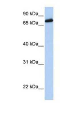 Western Blot: LRCH4 Antibody [NBP1-69265] - This Anti-LRCH4 antibody was used in Western Blot of Transfected 293T tissue lysate at a concentration of 1ug/ml.