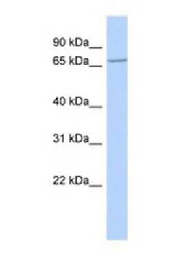 Western Blot: LRCH4 Antibody [NBP1-69266] - This Anti-LRCH4 antibody was used in Western Blot of Hela     tissue lysate at a concentration of 1ug/ml.