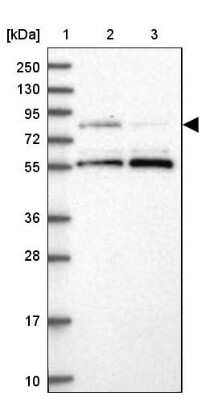 <b>Orthogonal Strategies Validation. </b>Western Blot: LRCH4 Antibody [NBP1-82821] - Lane 1: Marker  [kDa] 250, 130, 95, 72, 55, 36, 28, 17, 10.  Lane 2: Human cell line RT-4.  Lane 3: Human cell line U-251MG sp