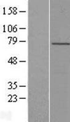 Western Blot: LRCH4 Overexpression Lysate (Adult Normal) [NBL1-12661] Left-Empty vector transfected control cell lysate (HEK293 cell lysate); Right -Over-expression Lysate for LRCH4.