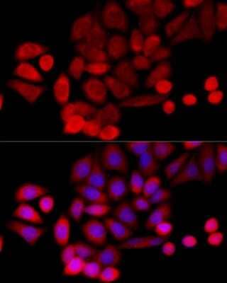 Immunocytochemistry/ Immunofluorescence PIDD Antibody - BSA Free