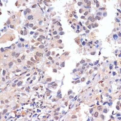 Immunohistochemistry-Paraffin PIDD Antibody - BSA Free