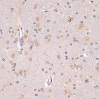 Immunohistochemistry-Paraffin PIDD Antibody - BSA Free