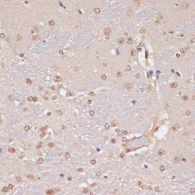 Immunohistochemistry-Paraffin: LRDD Antibody [NBP3-03535] - Paraffin-embedded mouse brain using LRDD antibody at dilution of 1:100 (40x lens).